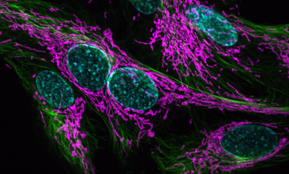 Carlini lab Carlini lab cells