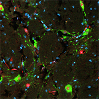 NBM w: DAPI + GFP + NeuN